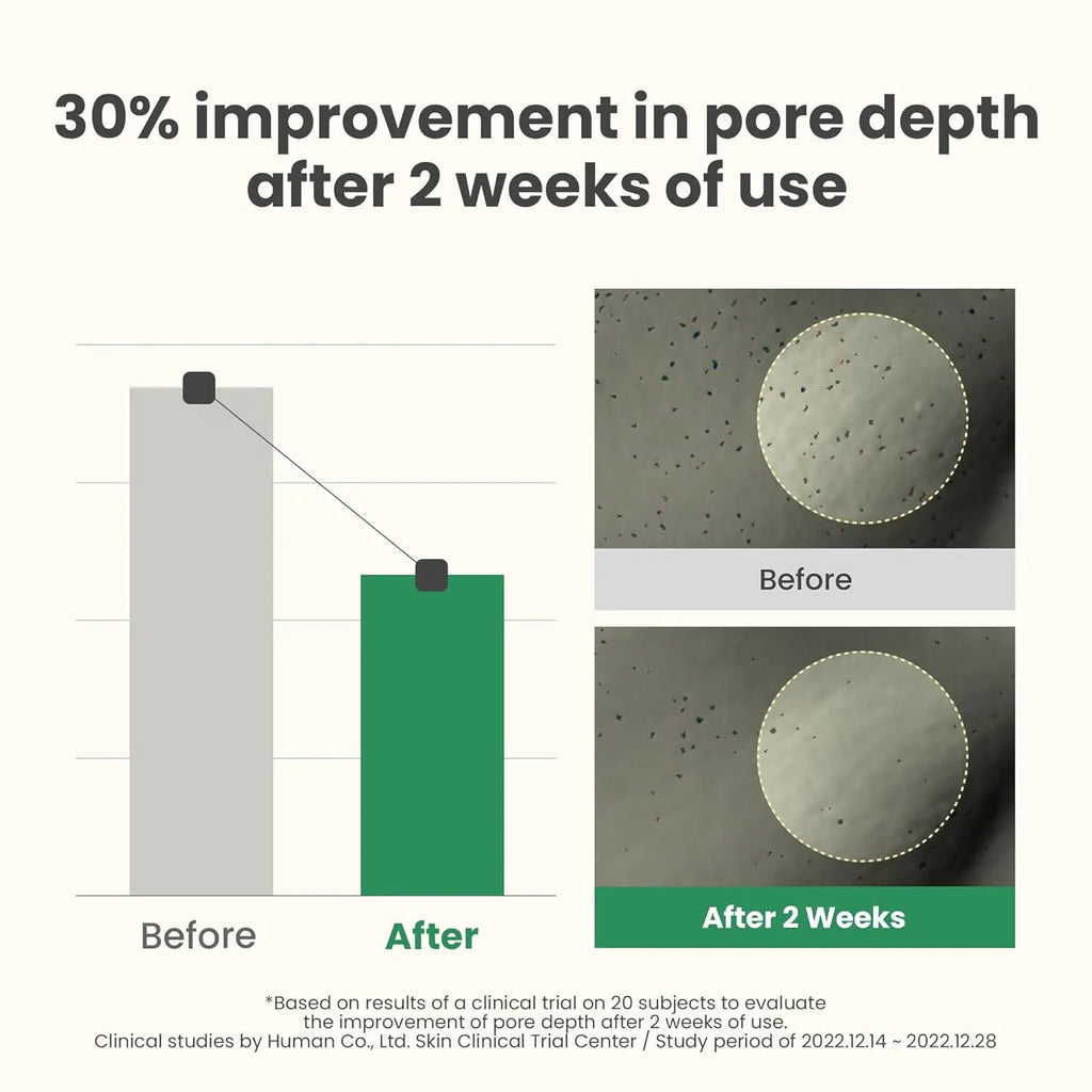 AXIS-Y LHA Peel & Fill Pore Balancing Cream