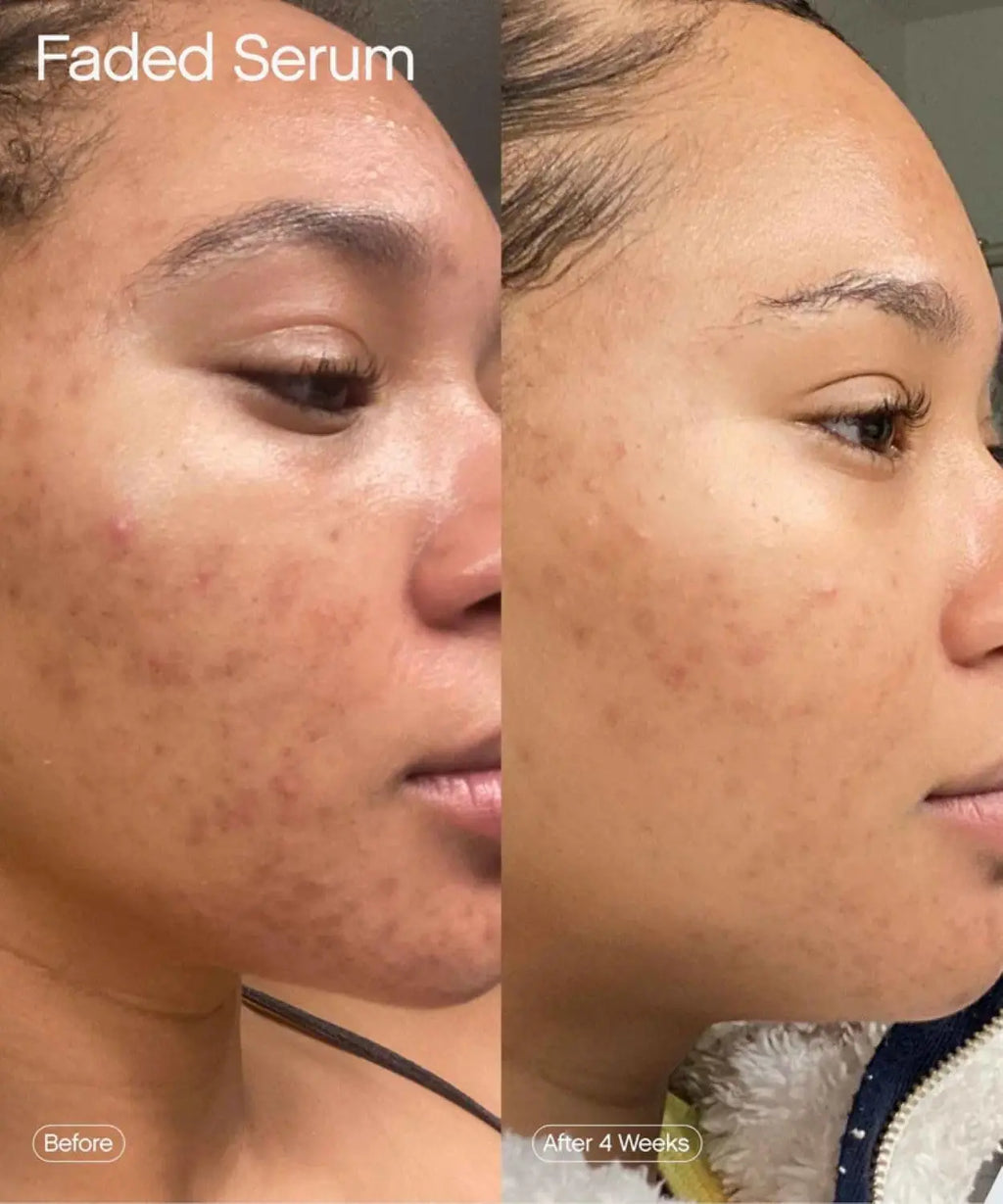 Topicals Faded Brightening & Clearing Serum