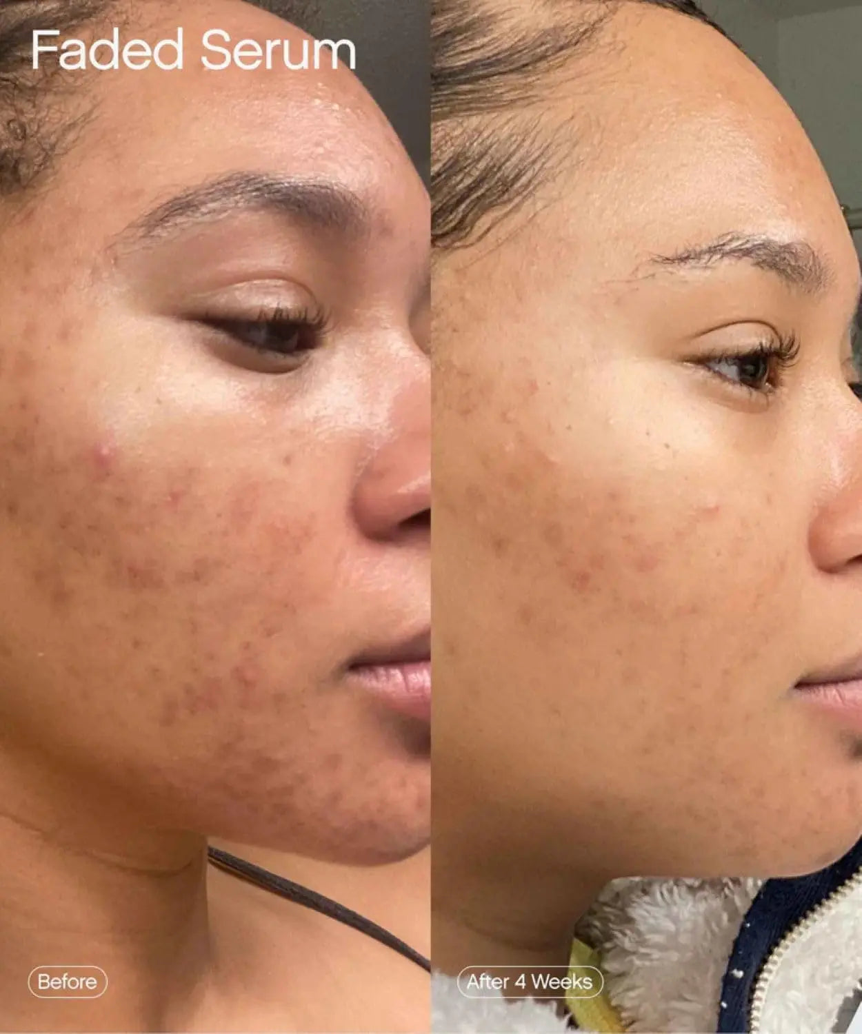 Topicals Faded Brightening & Clearing Serum