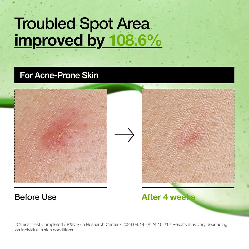 Anua Azelaic Acid 10 Hyaluron Redness Soothing Serum