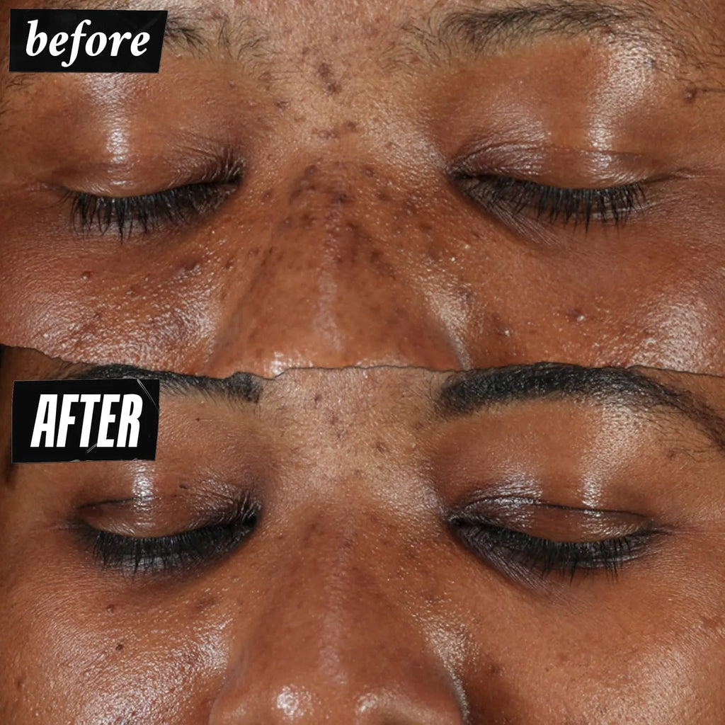 Kiehl's Clearly Corrective Dark Spot Serum