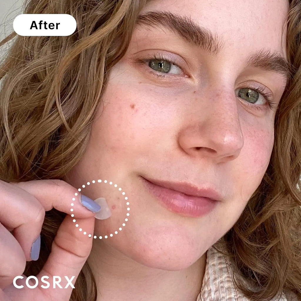 COSRX Acne Pimple Patch