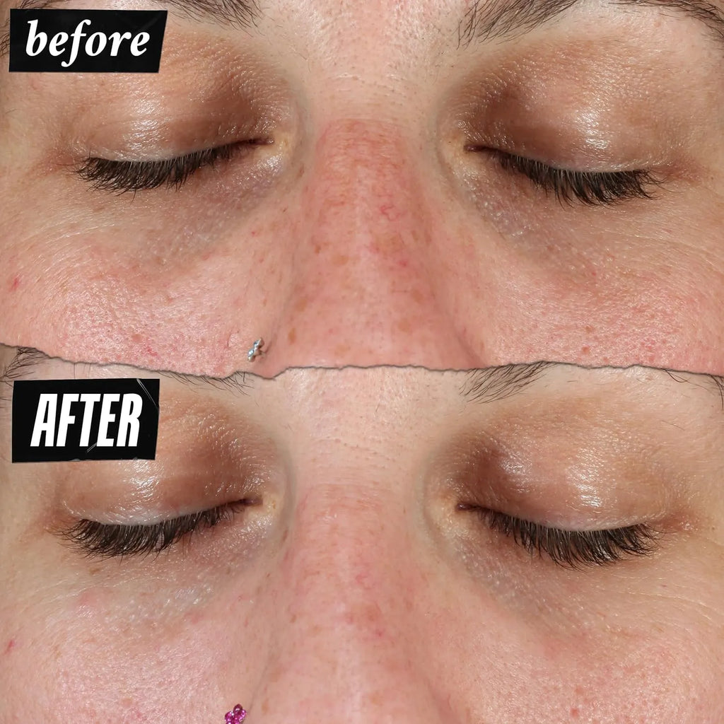 Kiehl's Clearly Corrective Dark Spot Serum