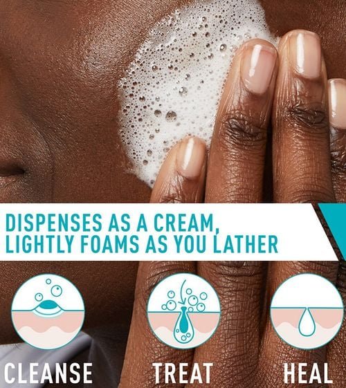 Cerave Acne Foaming Cream Cleanser