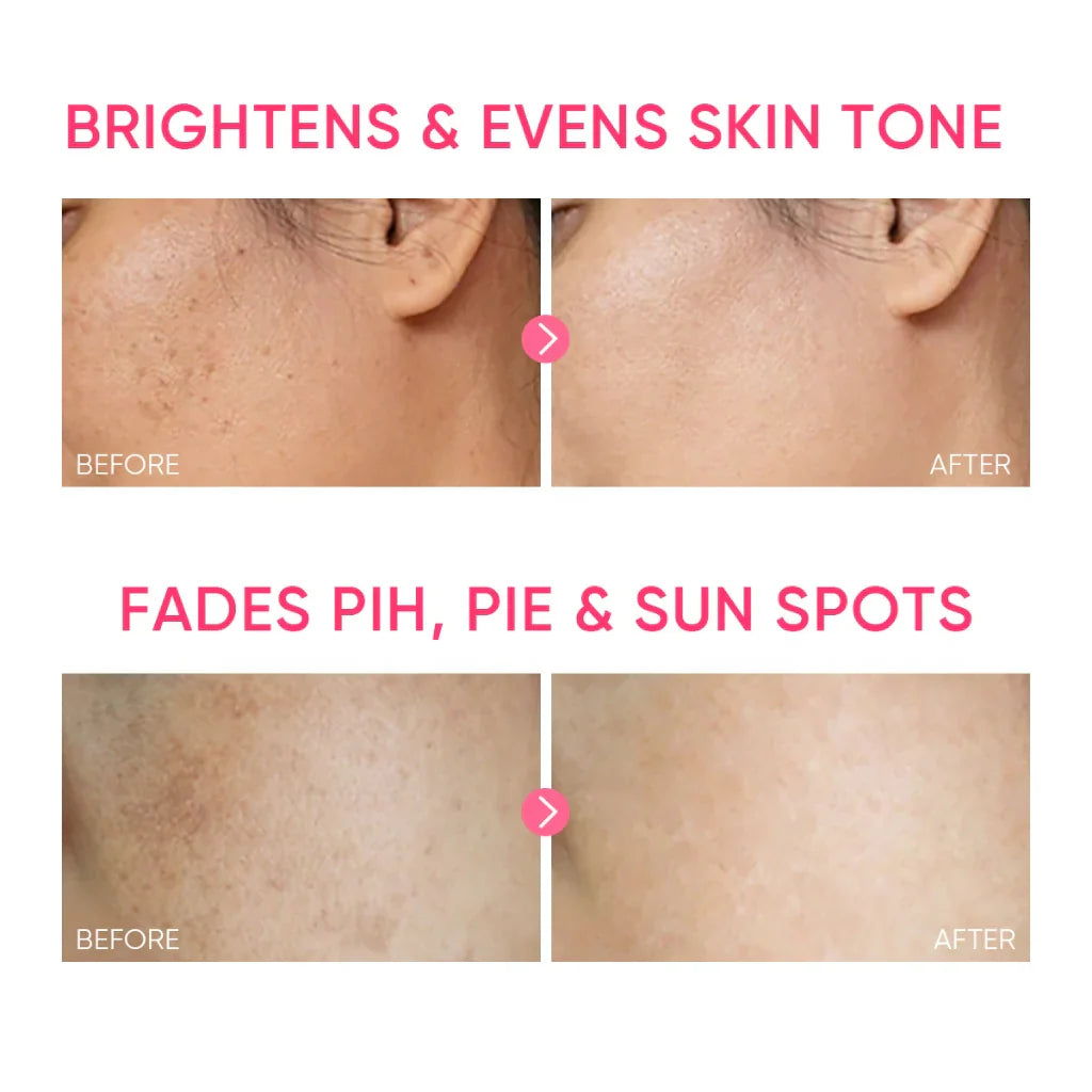Skintific MSH Niacinamide Brightening Moisture Gel